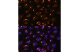 Immunofluorescence analysis of U2OS cells using MEK2 antibody (ABIN7268640) at dilution of 1:100. (MEK2 抗体  (AA 1-100))