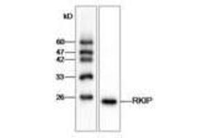 Image no. 1 for anti-Phosphatidylethanolamine Binding Protein 1 (PEBP1) antibody (ABIN791425) (PEBP1 抗体)