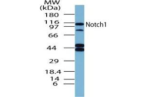 Image no. 1 for anti-Notch 1 (NOTCH1) (AA 1755-1767) antibody (ABIN207749) (Notch1 抗体  (AA 1755-1767))