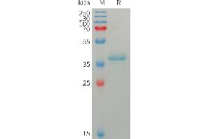 Human S100A4 Protein, hFc Tag on SDS-PAGE under reducing condition. (s100a4 Protein (AA 2-101) (Fc Tag))