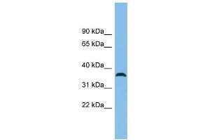 C18orf25 antibody used at 1 ug/ml to detect target protein. (C18ORF25 抗体  (N-Term))