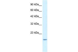 WB Suggested Anti-BAX Antibody Titration:  1. (BAX 抗体  (N-Term))