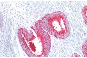 Immunohistochemistry staining of human uterus (paraffin-embedded sections) with anti-CD15 (MMA), 10 μg/mL. (CD15 抗体)