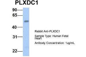 Host:  Rabbit  Target Name:  PLXDC1  Sample Type:  Human Fetal Heart  Antibody Dilution:  1. (PLXDC1 抗体  (N-Term))
