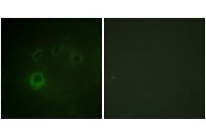 Immunofluorescence analysis of COS7 cells, using p70 S6 Kinase (Phospho-Ser418) Antibody. (RPS6KB1 抗体  (pSer418))