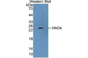 Detection of Recombinant APOB, Rat using Polyclonal Antibody to Apolipoprotein B (APOB) (APOB 抗体  (AA 2747-2913))