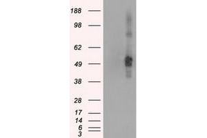 HEK293T cells were transfected with the pCMV6-ENTRY control (Left lane) or pCMV6-ENTRY CD4 (Right lane) cDNA for 48 hrs and lysed. (CD4 抗体)