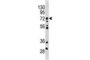 MELK antibody used in western blot to detect MRLK/MELK in mouse brain tissue lysate. (MELK 抗体  (AA 201-230))