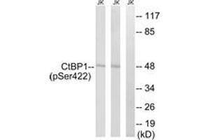 Western blot analysis of extracts from Jurkat cells treated with TNF 20ng/ml 30' and Jurkat cells treated with UV 15', using CtBP1 (Phospho-Ser422) Antibody. (CTBP1 抗体  (pSer422))