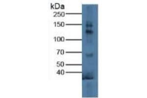 Western Blotting (WB) image for Klotho (KL) ELISA Kit (ABIN6730981)