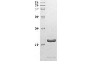 Validation with Western Blot (NPPB 蛋白)