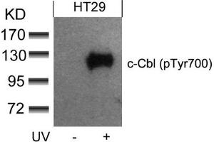 Western blot analysis of extracts from HT29 cells untreated or treated with UV using c-Cbl(phospho-Tyr700) Antibody. (CBL 抗体  (pTyr770))