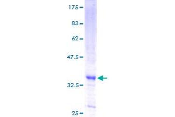 MAP3K3 Protein (AA 1-90) (GST tag)