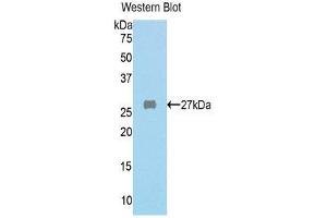 Western Blotting (WB) image for anti-Fumarylacetoacetate Hydrolase (Fumarylacetoacetase) (FAH) (AA 189-419) antibody (ABIN1858790) (FAH 抗体  (AA 189-419))