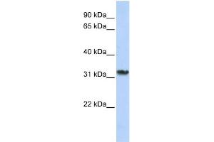WB Suggested Anti-SMNDC1 Antibody Titration:  0. (SMNDC1 抗体  (C-Term))