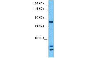 Host:  Rabbit  Target Name:  CSF3R  Sample Type:  293T Whole Cell lysates  Antibody Dilution:  1ug/ml (CSF3R 抗体  (N-Term))