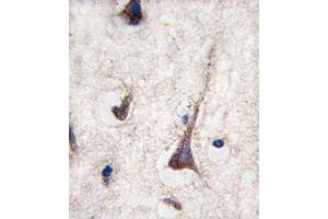 Immunohistochemistry (IHC) image for anti-CD3g Molecule, gamma (CD3-TCR Complex) (CD3G) antibody (ABIN2998378) (CD3G 抗体)