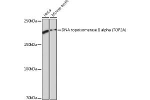 Western blot analysis of extracts of various cell lines, using DNA DNA topoisomerase II alpha (TOP2A) (TOP2A) Rabbit mAb (ABIN7270852) at 1:1000 dilution. (Topoisomerase II alpha 抗体)