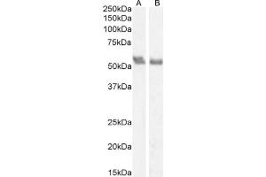 Western Blotting (WB) image for anti-Coronin, Actin Binding Protein, 1A (CORO1A) (C-Term) antibody (ABIN185063)