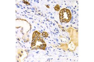 Immunohistochemistry of paraffin-embedded human kidney using KRT15 antibody. (KRT15 抗体)