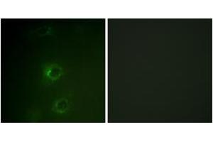 Immunofluorescence analysis of COS7 cells, using CBL (Ab-700) Antibody. (CBL 抗体  (AA 666-715))
