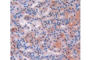 IHC-P analysis of adrenal gland tissue, with DAB staining. (IL-17 抗体  (AA 18-150))