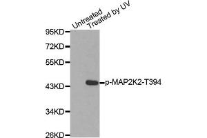 Western Blotting (WB) image for anti-Mitogen-Activated Protein Kinase Kinase 2 (MAP2K2) (pThr394) antibody (ABIN1870344) (MEK2 抗体  (pThr394))