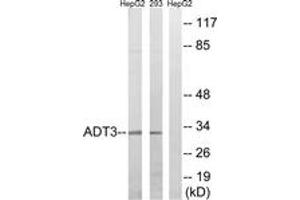 Western blot analysis of extracts from HepG2/293 cells, using SLC25A6 Antibody. (SLC25A6 抗体  (AA 121-170))
