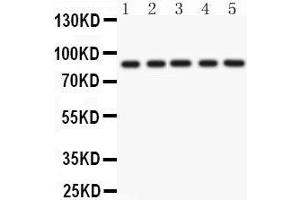 Anti- CD36 Picoband antibody, Western blotting All lanes: Anti CD36  at 0. (CD36 抗体  (N-Term))