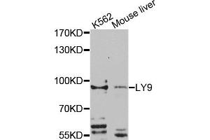 Western blot analysis of extracts of K562 and mouse liver cells, using LY9 antibody. (LY9 抗体)