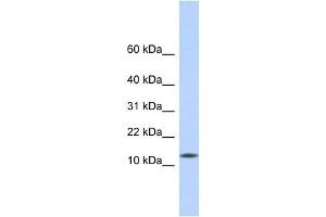 CDRT4 antibody used at 1 ug/ml to detect target protein. (CDRT4 抗体  (Middle Region))