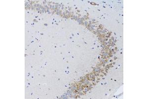 Immunohistochemistry of paraffin-embedded rat brain using TNFSF12 Antibody (ABIN1876860) at dilution of 1:100 (20x lens). (TWEAK 抗体)