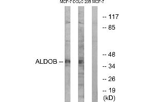 Western blot analysis of extracts from MCF-7 cells and HUVEC cells, using ALDOB antibody. (ALDOB 抗体  (Internal Region))