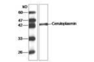 Image no. 1 for anti-Ceruloplasmin (Ferroxidase) (CP) (AA 933-1065) antibody (ABIN791453) (Ceruloplasmin 抗体  (AA 933-1065))