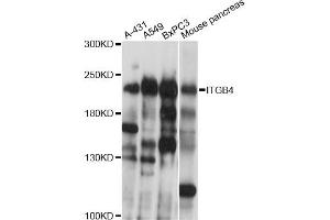 Western blot analysis of extracts of various cell lines, using ITGB4 antibody (ABIN5970319) at 1/1000 dilution. (Integrin beta 4 抗体)