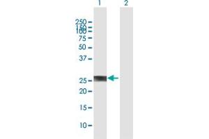 Western Blot analysis of PROP1 expression in transfected 293T cell line by PROP1 MaxPab polyclonal antibody. (PROP1 抗体  (AA 1-226))