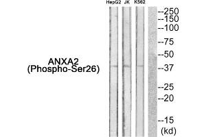 Western Blotting (WB) image for anti-Annexin A2 (ANXA2) (pSer26) antibody (ABIN1847876) (Annexin A2 抗体  (pSer26))