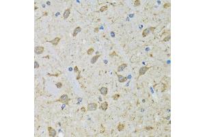 Immunohistochemistry of paraffin-embedded mouse brain using DHRS2 antibody (ABIN5973846) at dilution of 1/100 (40x lens). (DHRS2 抗体)