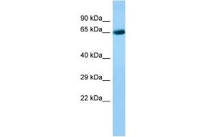Host: Rabbit Target Name: ACOXL Sample Type: Fetal Liver lysates Antibody Dilution: 1. (ACOXL 抗体  (C-Term))