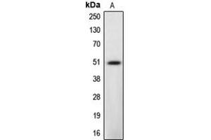 Western blot analysis of Caspase 12 expression in L929 (A) whole cell lysates. (Caspase 12 抗体  (Center))