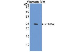 Western Blotting (WB) image for anti-Caldesmon 1 (CALD1) (AA 28-207) antibody (ABIN1858221) (Caldesmon 抗体  (AA 28-207))