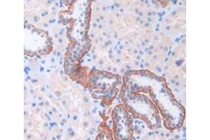 IHC-P analysis of Human Kidney Tissue, with DAB staining. (CENPI 抗体  (AA 292-528))