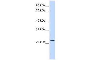 SCAND2 antibody used at 0. (SCAND2 抗体  (Middle Region))