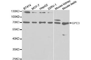 Western blot analysis of extracts of various cell lines, using GPC3 antibody (ABIN5971006) at 1/1000 dilution. (Glypican 3 抗体)