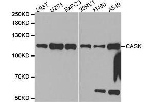Western blot analysis of extracts of various cell lines, using CASK antibody (ABIN5971336) at 1/1000 dilution. (CASK 抗体)
