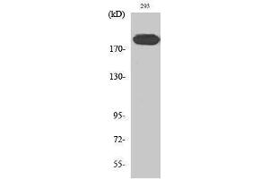 Western Blotting (WB) image for anti-Insulin Receptor Substrate 1 (IRS1) (Ser62) antibody (ABIN3175713) (IRS1 抗体  (Ser62))