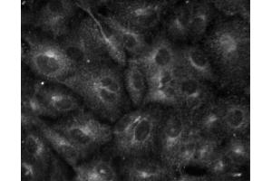 Immunofluorescent staining of A549 (ATCC CCL-185) cells. (pi 4-Kinase, beta (AA 411-626) 抗体)