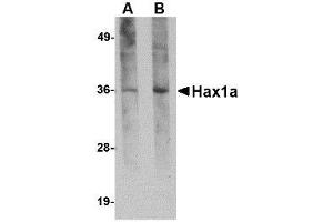 Image no. 1 for anti-HCLS1 Associated Protein X-1 (HAX1) (N-Term) antibody (ABIN341762) (HAX1 抗体  (N-Term))