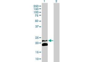 Western Blot analysis of IFNB1 expression in transfected 293T cell line by IFNB1 MaxPab polyclonal antibody. (IFNB1 抗体  (AA 1-187))