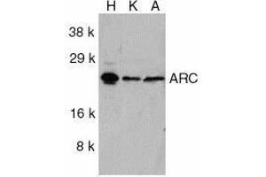 Western blot analysis of ARC in HeLa (H), KB (K), and A549 (A) whole cell lysates with ARC antibody at 1ug/ml. (NOL3 抗体  (C-Term))